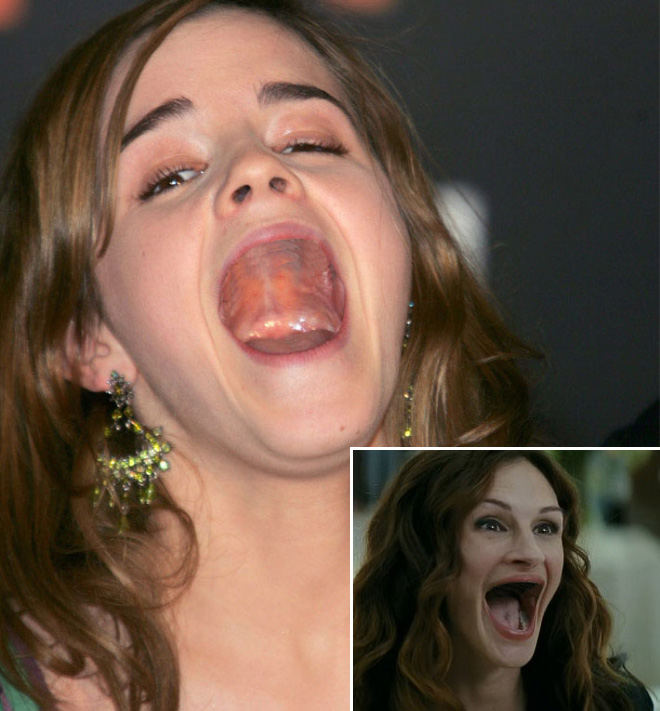 Celebrities With No Teeth