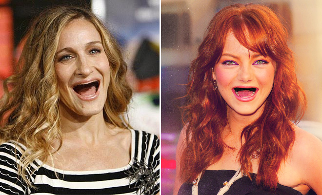 Celebrities With No Teeth