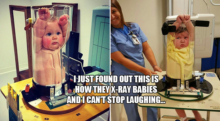 This Is How They X-Ray Babies