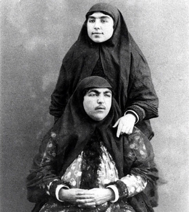 This woman was considered beautiful in Persia in 1900s.