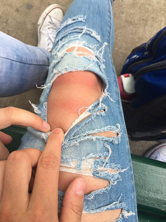 Spending time in the sun while wearing ripped jeans might not be the smartest choice.