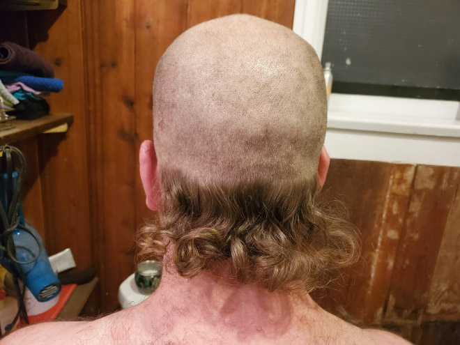 Skullet: the worst form of mullet.